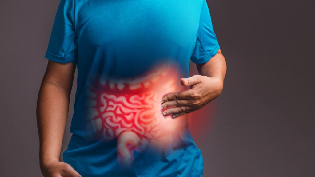 Câncer de intestino: causas, sinais e prevenção Câncer de intestino: causas, sinais e prevenção