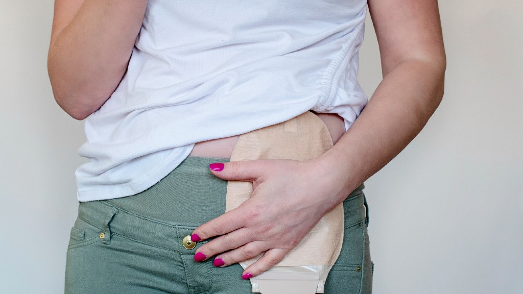 Cuidados com a bolsa de colostomia Cuidados com a bolsa de colostomia